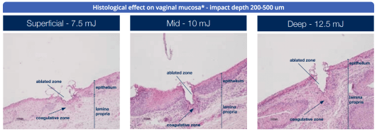 Screen Shot 2018-04-30 at 4.04.14 PM